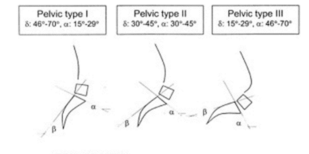 Pelvis