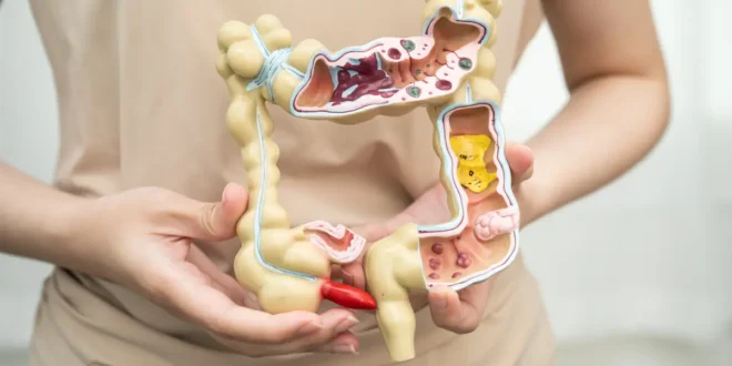 Comment la flore intestinale est-elle détruite ? Comment la flore intestinale est-elle détruite ?