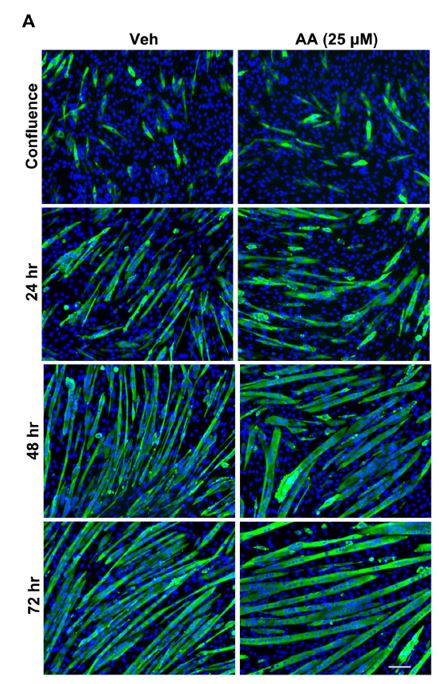 Myo fibres et arachidonique Myo fibres et arachidonique