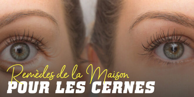 Attention aux Cernes : Nous vous disons les Meilleurs Remèdes Maison