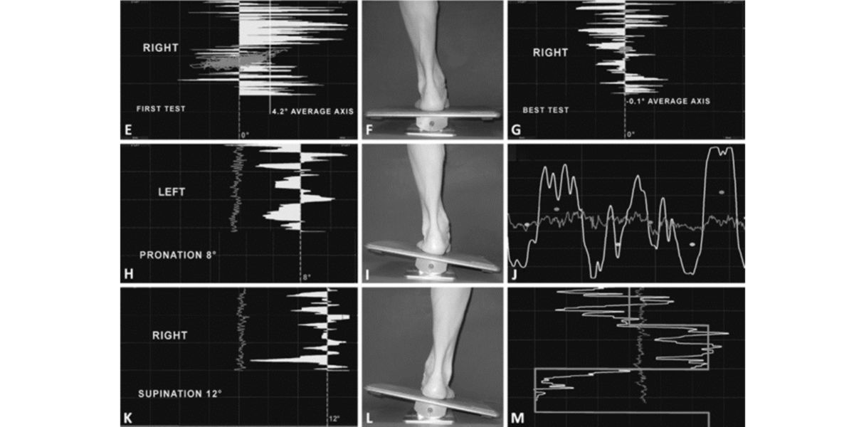 Plate-forme de pressions
