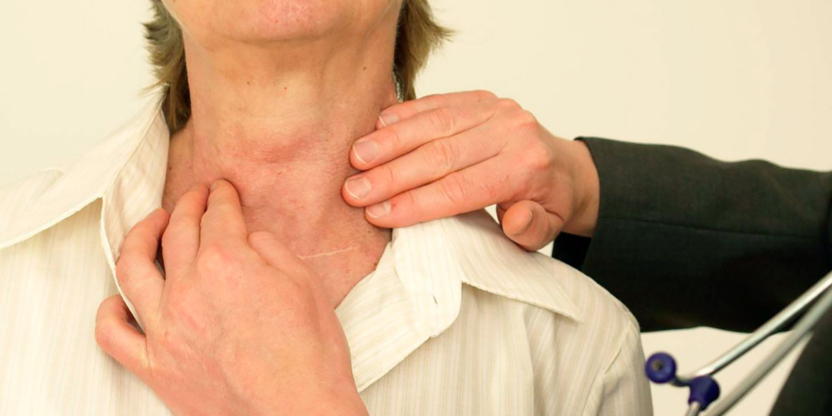 Glande thyroïde