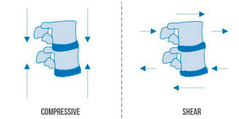 Compression-Traction Compression-Traction
