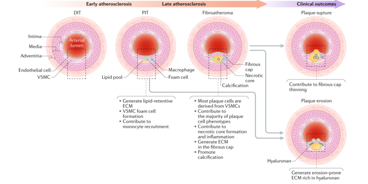 Nattokinase pour le système cardiovasculaire
