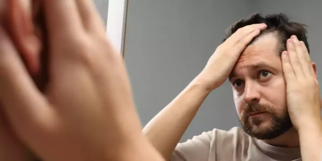 Comment traiter l’alopécie et prévenir la chute des cheveux
