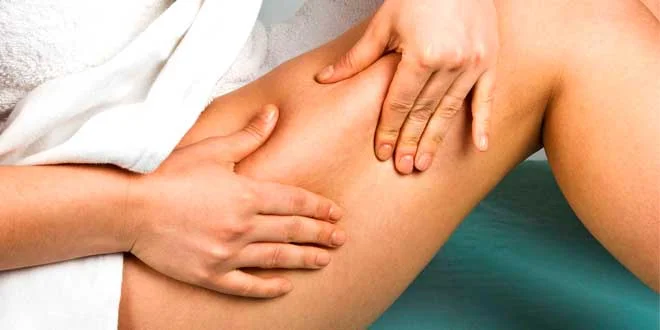 Cellulite : qu’est-ce que c’est, pourquoi elle apparaît chez les femmes, causes, comment l’éliminer