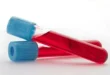 Paramètres bizarres dans les analyses quand on utilise des stéroïdes