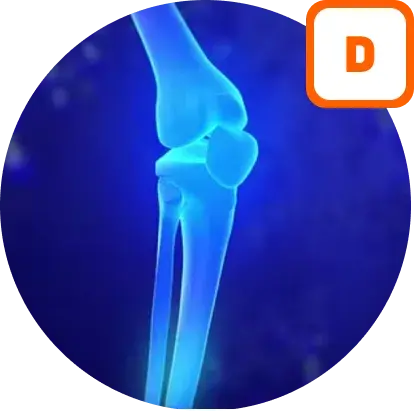 Vitamine D sur le développement osseux